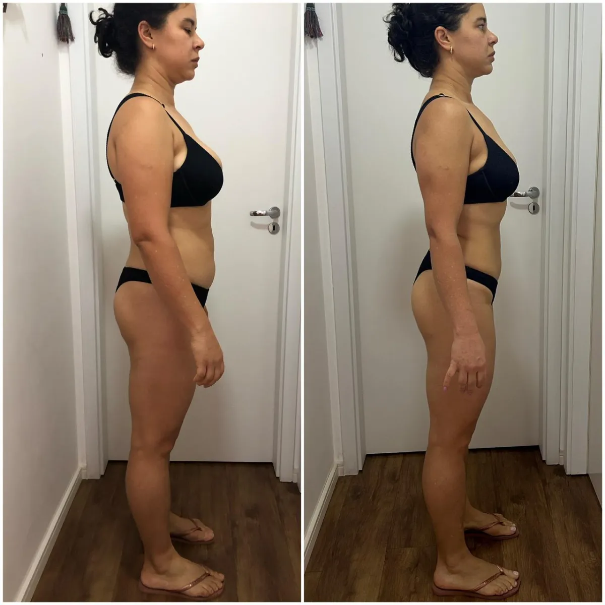 Resultado real de Rosangela com o Método Base GDTeam — antes